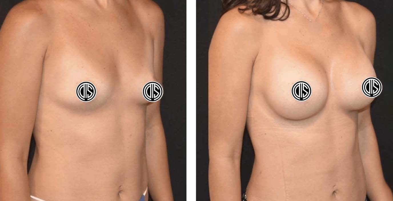 Before and after photo 9