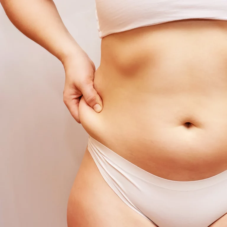 A person wearing white underwear pinches the skin on their side, showing a close-up of their midsection, possibly highlighting areas targeted during Lipo 360.