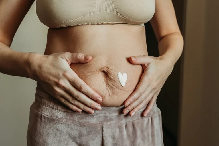 A person with stretch marks on their abdomen, embracing postpartum body confidence, applies heart-shaped cream to their skin using both hands.