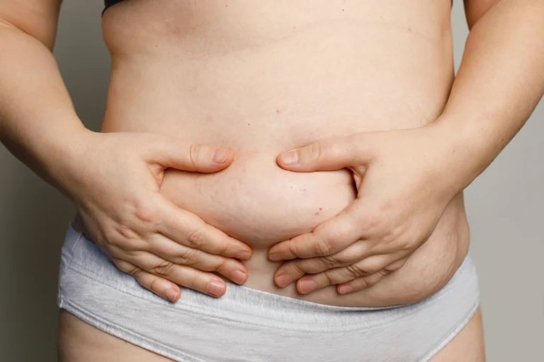 Close-up of a person wearing underwear, lightly squeezing the skin and fat on their abdomen with both hands, contemplating an auto draft for fitness motivation.