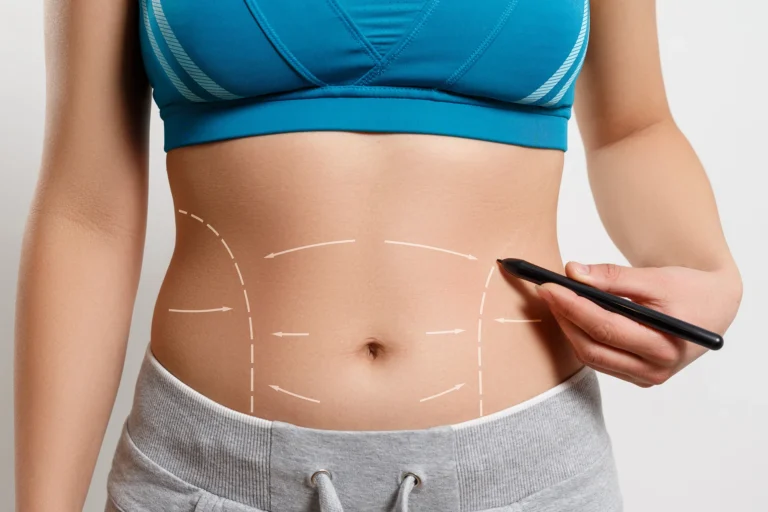 A person in a blue sports bra and gray shorts marks dashed lines on their bare midsection with a black marker, perhaps sketching out plans for an upcoming auto draft.
