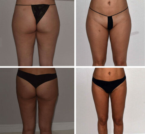 A four-panel image showcases the front and back views of a person in minimal black clothing, capturing the transformative journey in body size or composition with a precision that feels almost like an auto draft of change.