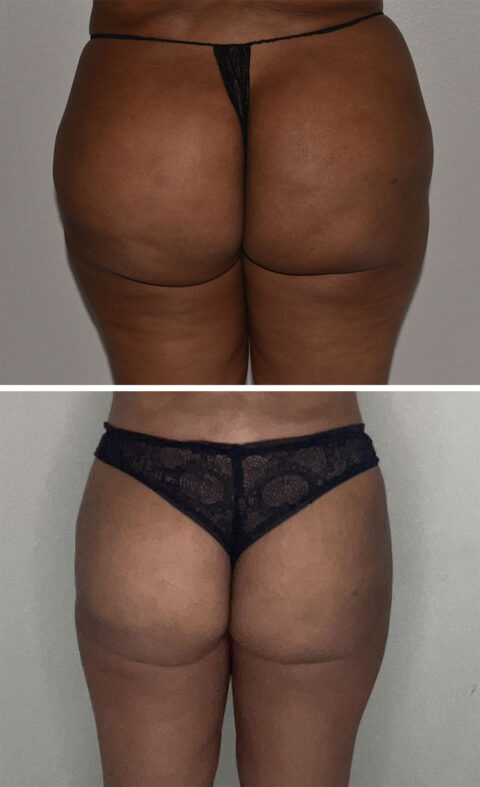 Two images highlight a person from behind wearing varied underwear: the top features a sleek black thong, while the bottom showcases elegant black lace panties. This auto-draft beautifully captures the subtle differences in style and texture.