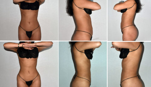 A series of six images showcases a person in black lingerie, highlighting their waist and abdomen from different angles against a plain background.