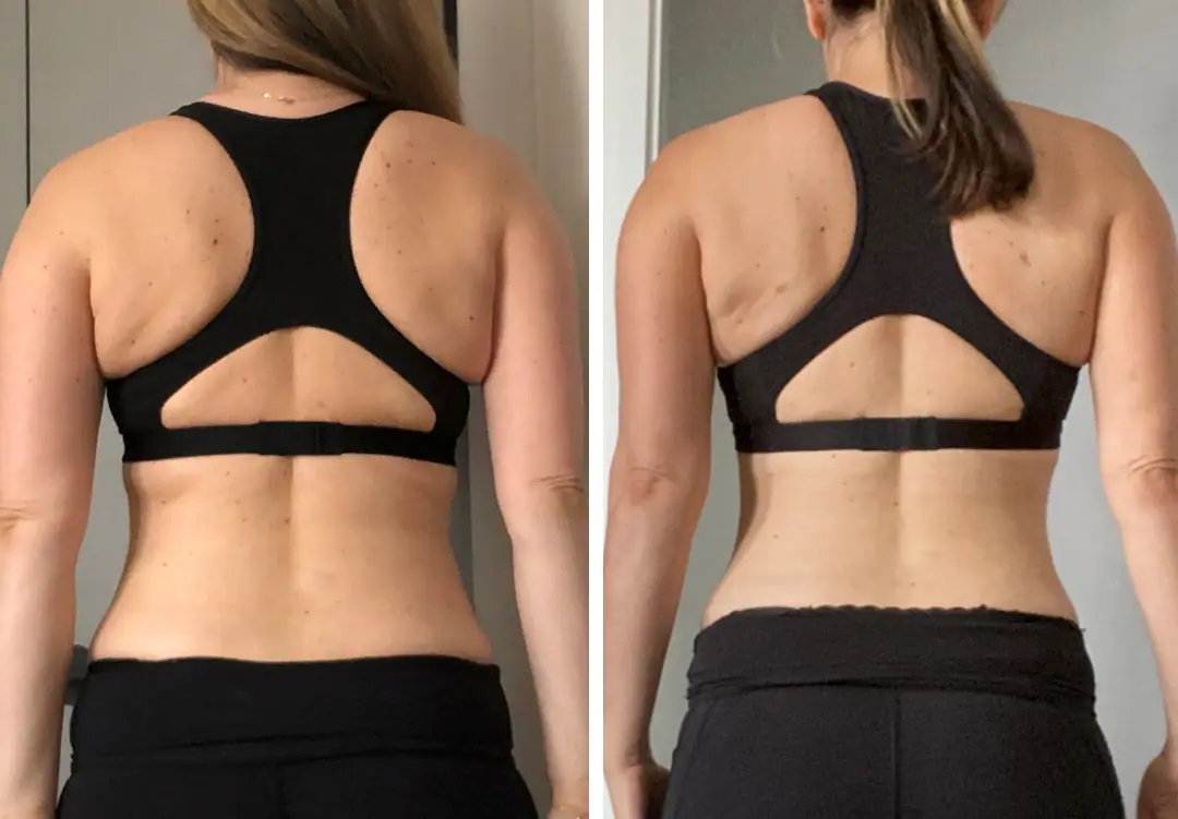 Before and after photo 6