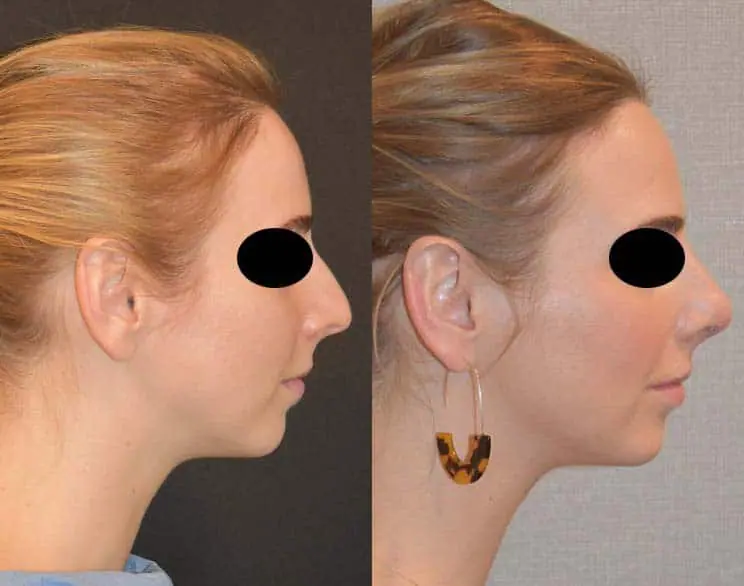 Before and after photo 7